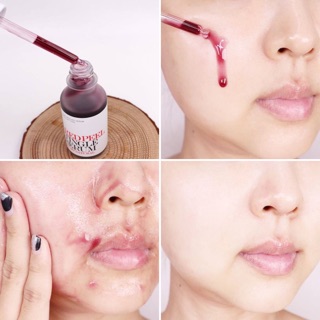 Serum Red Peel Tingle Serum 35ml