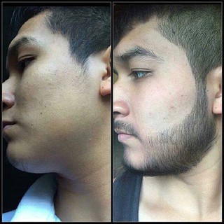 Serum MỌC RÂU-MỌC TÓC- MỌC LÔNG MÀY BEARD OIL-UAE