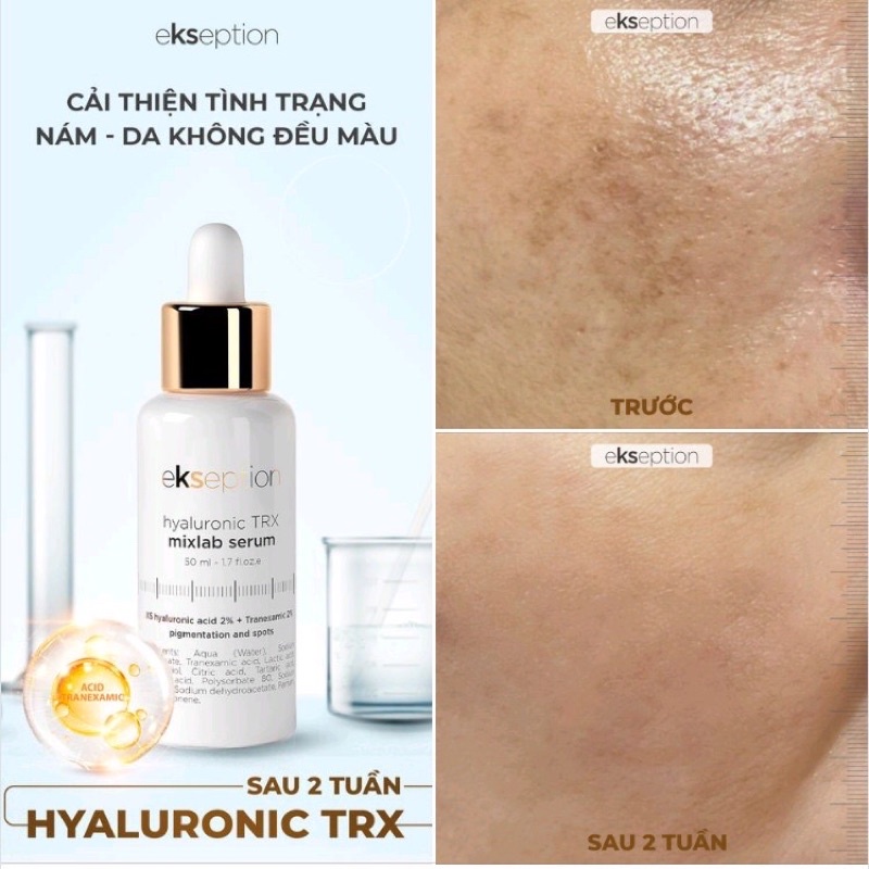 Serum dưỡng trắng sáng da, cải thiện sạm nám Ekseption Hyaluronic TRX