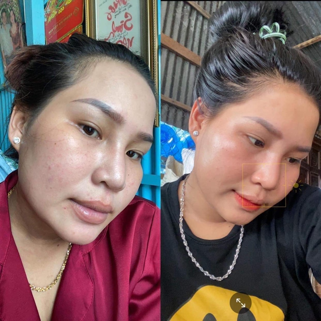 LE’PEAU - Peel da Vi Tảo Retinol  x 2