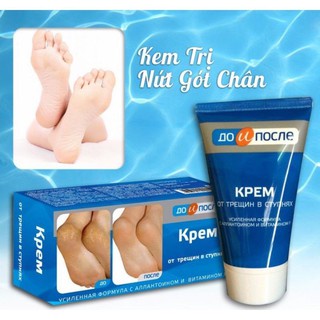 Kem giảm nứt nẻ và phục hồi gót chân Kpem Apteka Nga 50ml