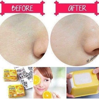 Mặt nạ Melano CC