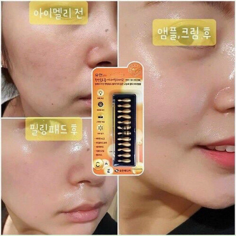 Viên Collagen Tươi Ammud Multi Vita Ampoule Hàn Quốc Vỉ 12 Viên