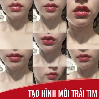 Tạo Hình Môi Tim