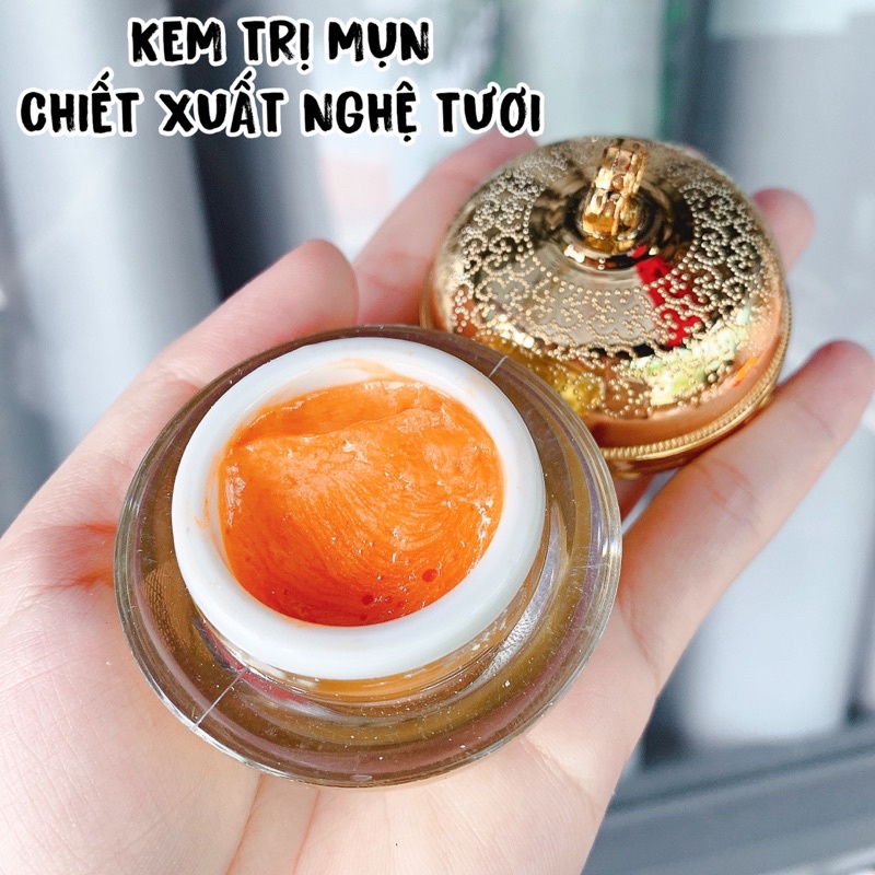 KEM MỤN CHIẾT XUẤT NGHỆ TƯƠI