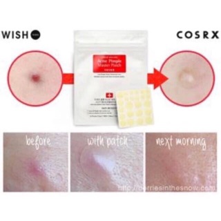 Miếng Dán Mụn Acne Pimple Master Patch Cosrx
