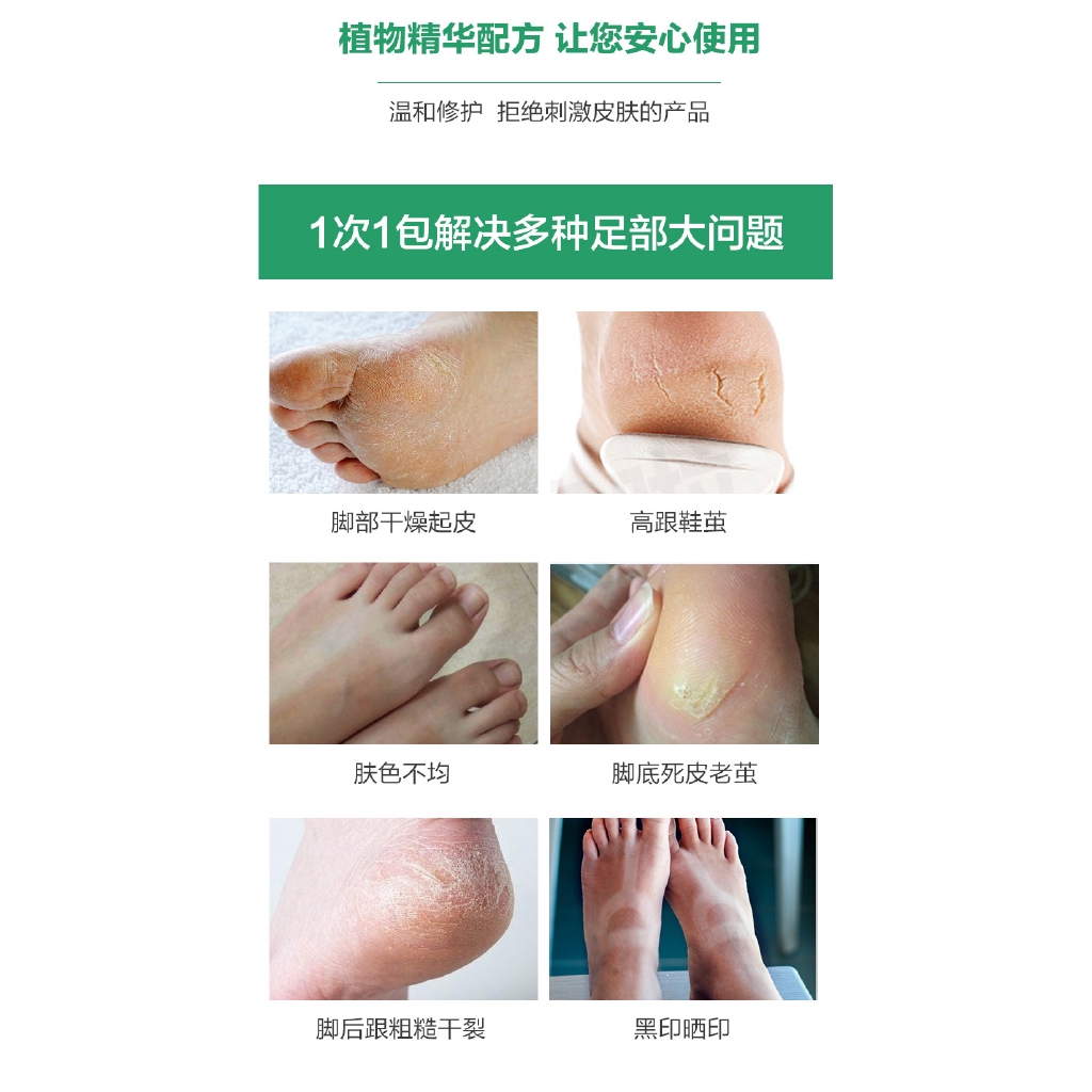 [Hàng mới về] Mặt nạ chân Aisha Ni chiết xuất thực vật tẩy tế bào chết dưỡng ẩm làm trắng da tiện lợi