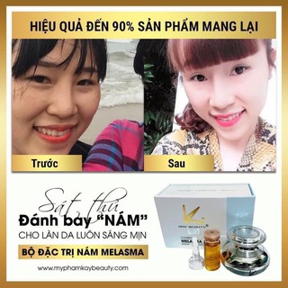 Combo Nám kay beauty (diễn viên NGÂN QUỲNH sử dụng)