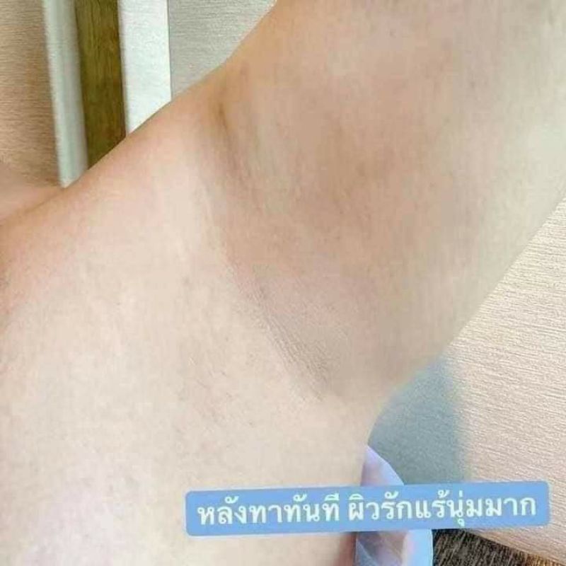 Kem Pure💙 dưỡng thâm nách💫 thâm mông Thái Lan Chính Hãng🇹🇭