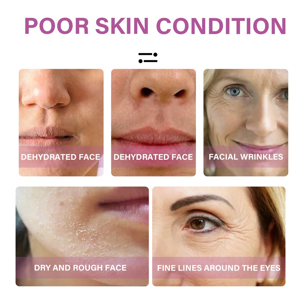 Serum Ceramide Chuyên Nghiệp Dưỡng Ẩm Chống Nếp Nhăn