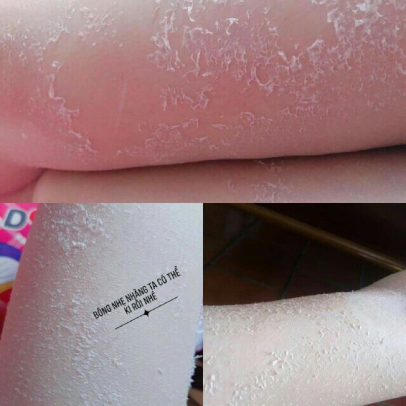 Kem Body Bong Tái Tạo Da Handmade Kim Spa Cao Cấp Không Hoá Chất