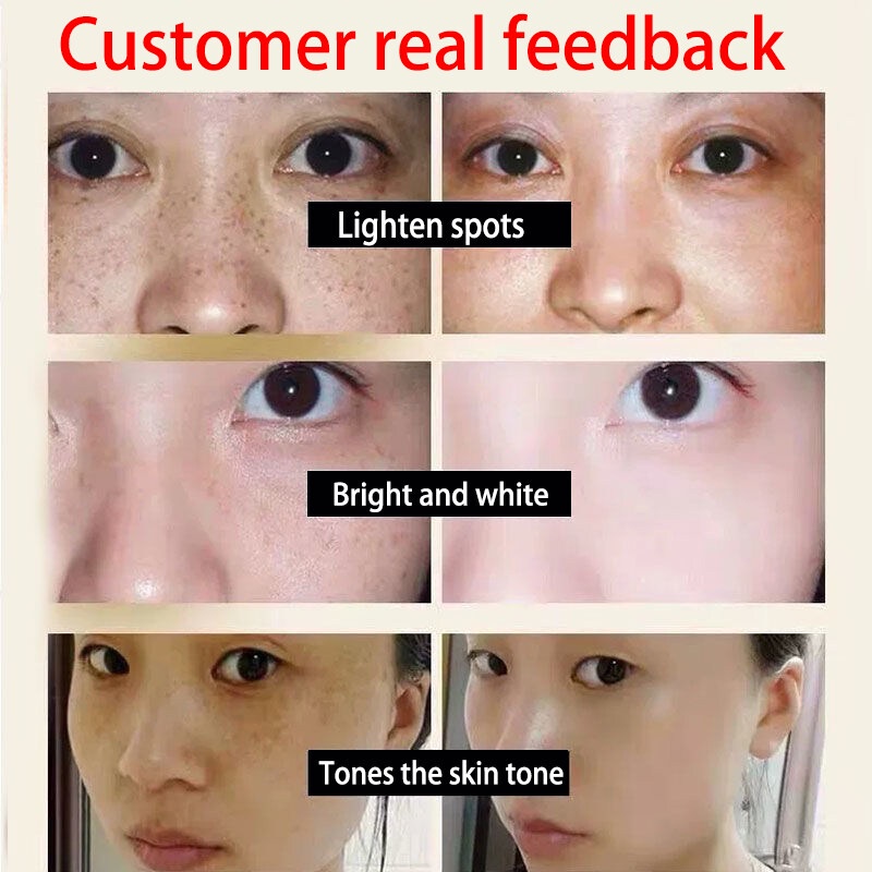 Kem Dưỡng Trắng Da Ban Ngày Chống Tàn Nhang Và Đốm Đen Hiệu Quả