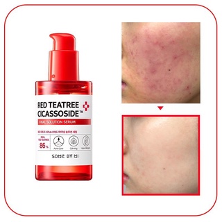 Serum Some By Mi RED TEA TREE