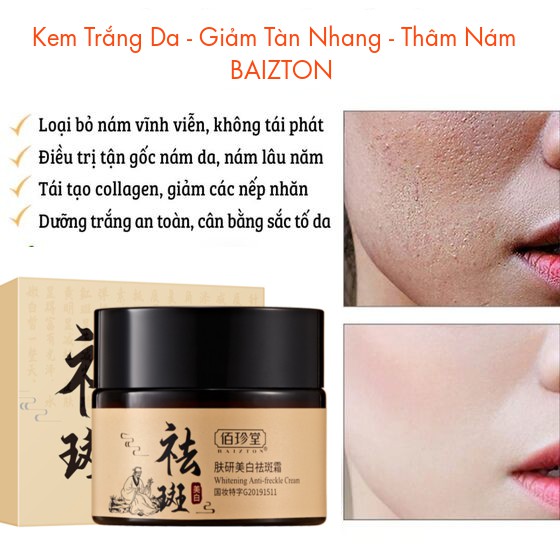 Kem nám và chống tàn nhang thảo dược BAIZTON da trắng sáng và dưỡng ẩm - Hiệu quả chỉ 28 ngày sử dụng A189