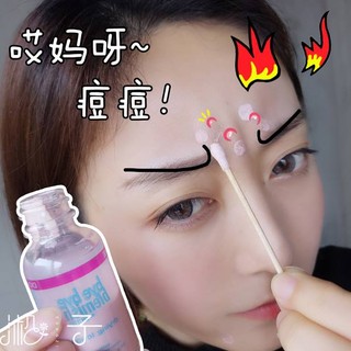 Lotion Đẩy Mụn Bye Bye Blemish Drying Lotion