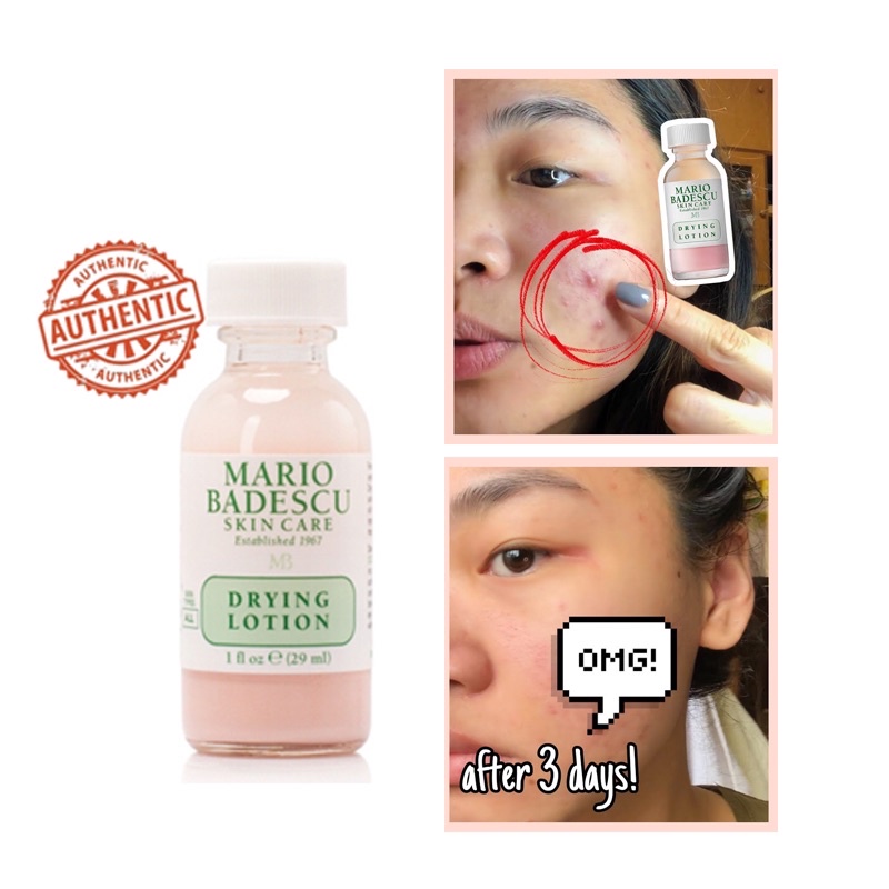 [BILL SEPHORA] Chấm mụn Mario Badescu Drying Lotion Tách set