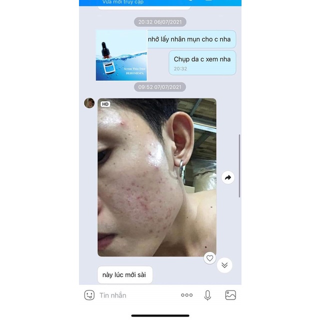 Serum giảm mụn mờ thâm se khít lỗ chân lông Behome Spa | BigBuy360 - bigbuy360.vn
