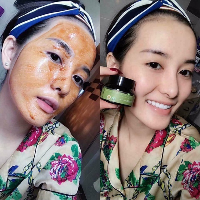 Cao neem - nụ cười vàng