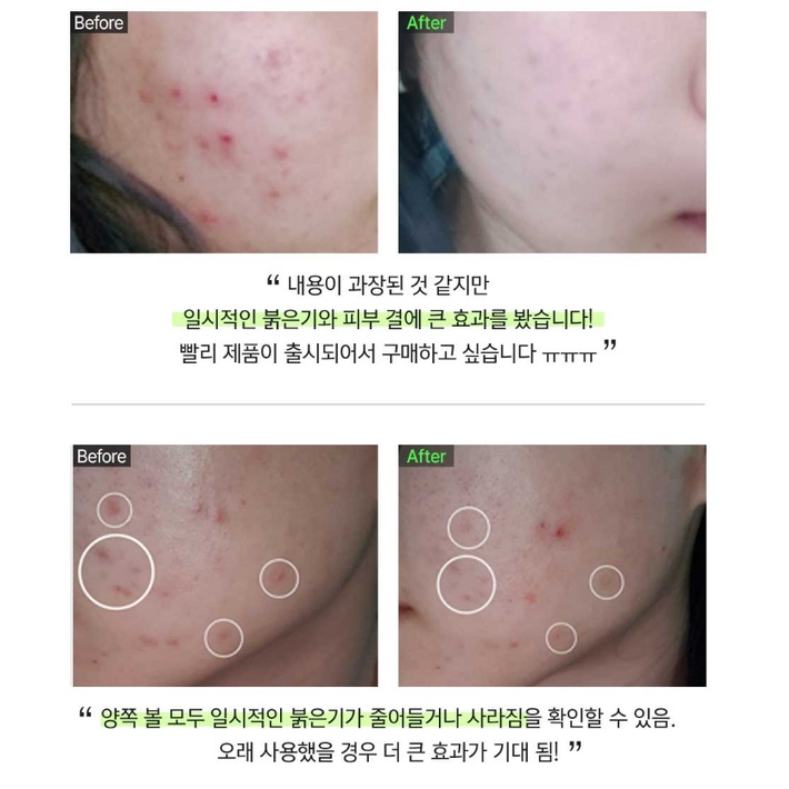 Serum Nosca 9 chăm sóc da dung tích 30ml
