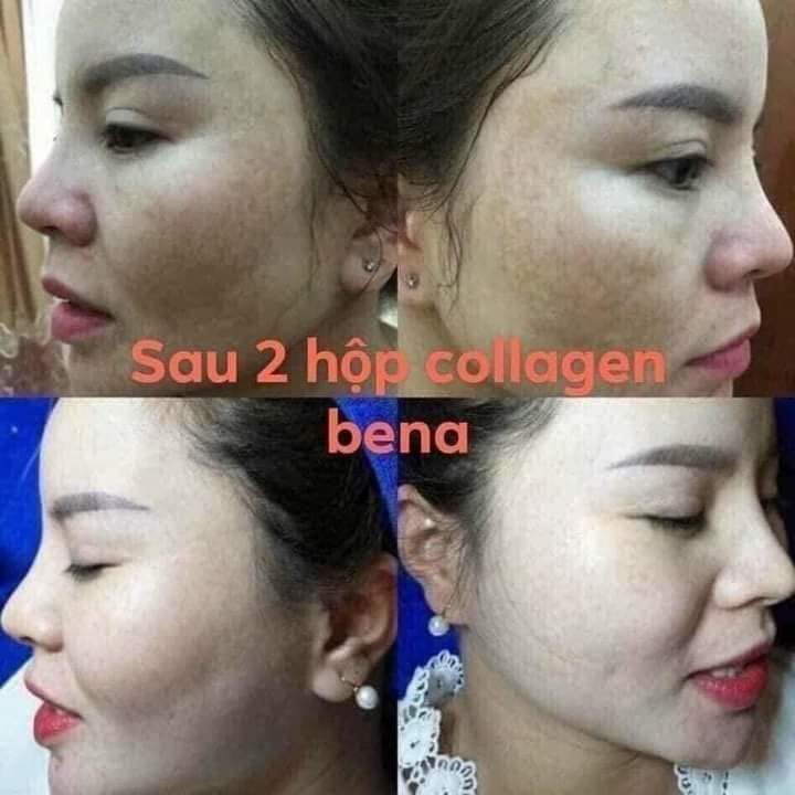 Combo 3 gói bột uống collagen bena trắng sáng da, cấp ẩm, chống lão hoá