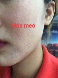 SERUM GON DƯỠNG TRẮNG HỒNG DA