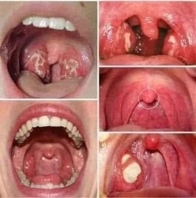 TINH DẦU RĂNG MIỆNG CỦA DẠ THẢO LIÊN CHỮA ĐƯỢC 29 VẤN ĐỀ  THƯỜNG gặp