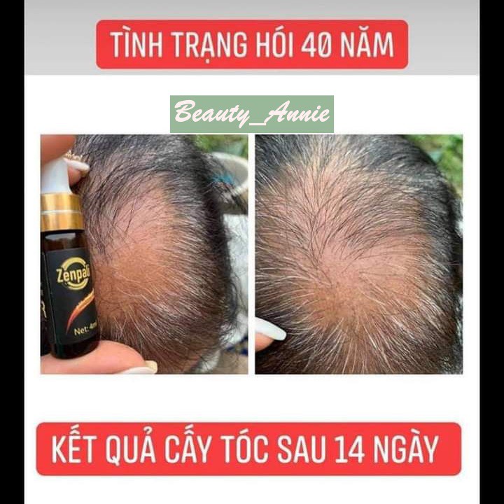 Zenpali Tinh chất dài mi mọc tóc Dr Hair 10ml💎𝙃𝙖̀𝙣𝙜 𝘼𝙪𝙩𝙝💎 🍀Cấy mi sinh học nano - Hói tóc ngắn mi đã có Dr Hair🍀