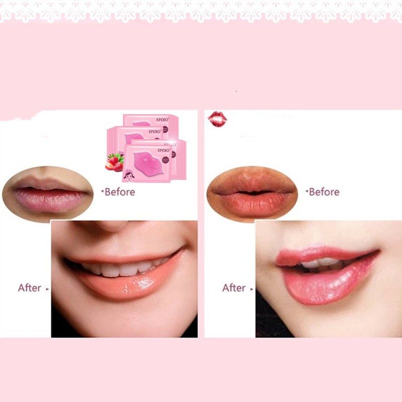 Mặt nạ môi dưỡng ẩm bổ sung collagen cho đôi môi căng mọng | BigBuy360 - bigbuy360.vn