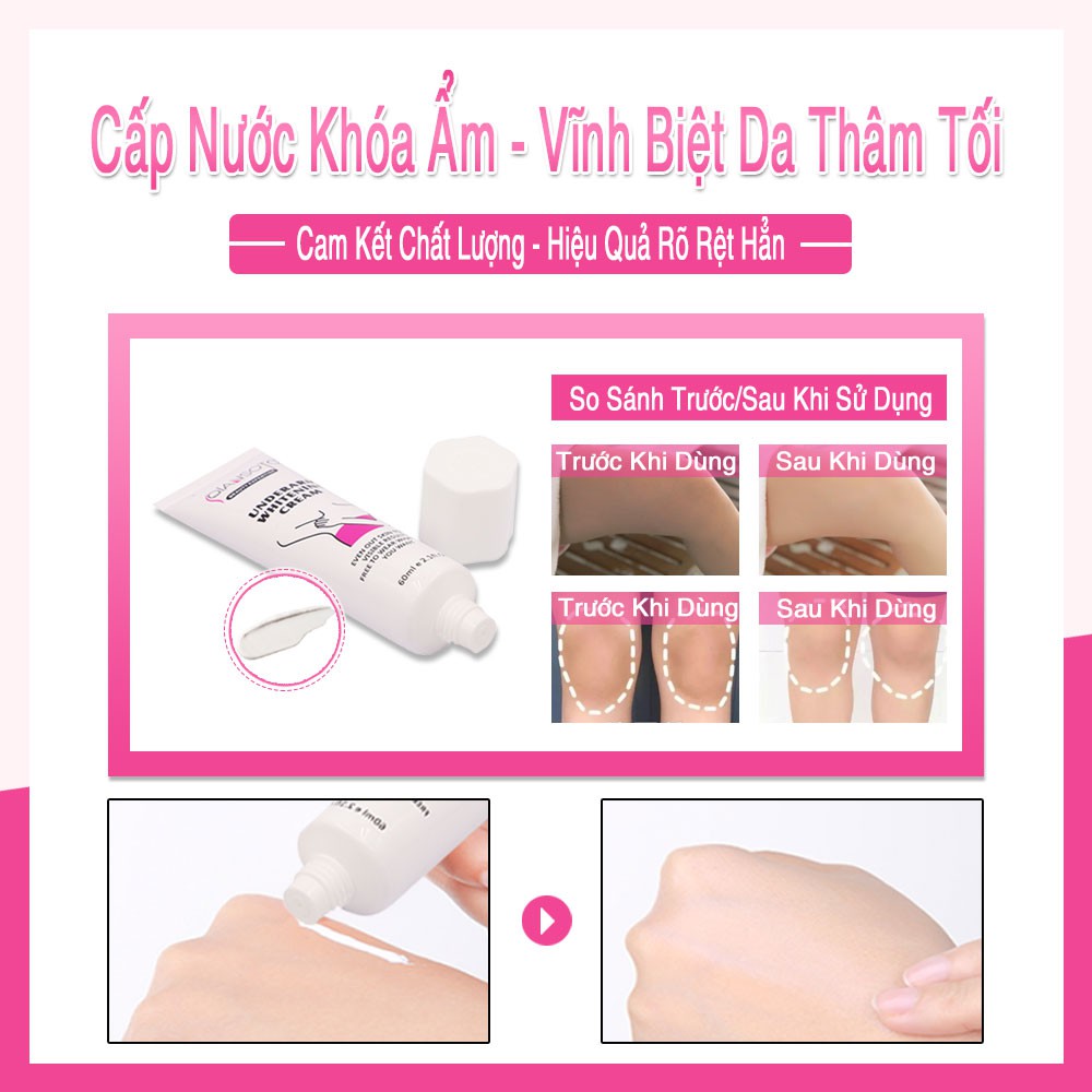 [Hàng nhập khẩu] QIANSOTO Kem Làm Trắng Da Nách Giảm Thâm Đầu Gối Mông Bikini Khử Mùi Hôi Dưỡng Trắng Da 60g (Che tên)