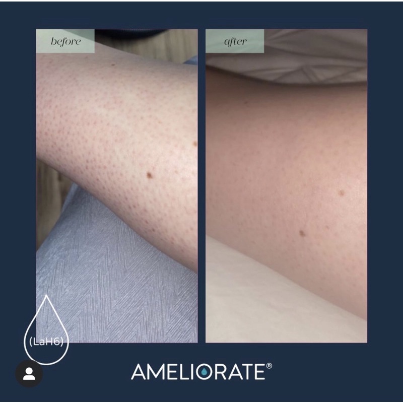 | TRẢ ORDER | SỮA DƯỠNG THỂ TRANSFORMING BODY LOTION AMELIORATE | BigBuy360 - bigbuy360.vn