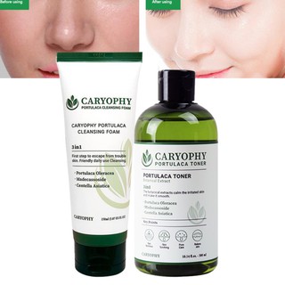 Combo Toner và Sữa rửa mặt dành cho da mụn hỗ trợ trị mụn tận gốc