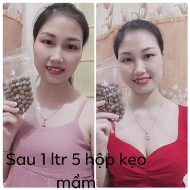 Kẹo mầm lúa mạch gold thảo mộc 37