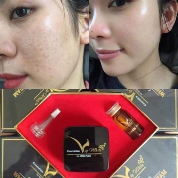 Bộ Kem Dưỡng Trắng Da Mặt Face White skin cream Vip White kèm serum dưỡng trắng da mặt Vip White