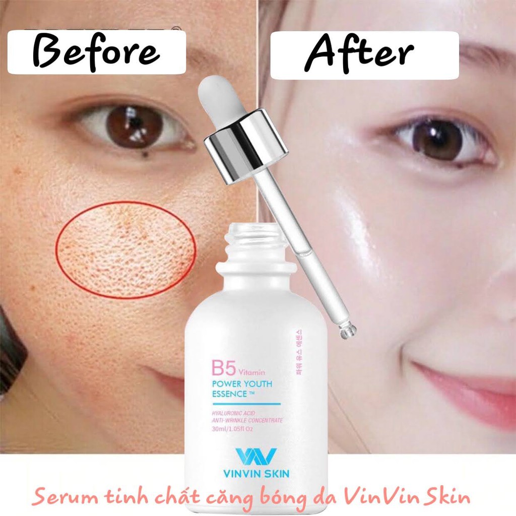 SERUM CĂNG BÓNG DA (POWER YOUTH ESSENCE)  - VinVin Skin | BigBuy360 - bigbuy360.vn