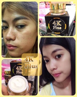 🍒🍒KEM 4K PLUS THÁI LAN SIÊU DƯỠNG TRẮNG DA🍒🍒