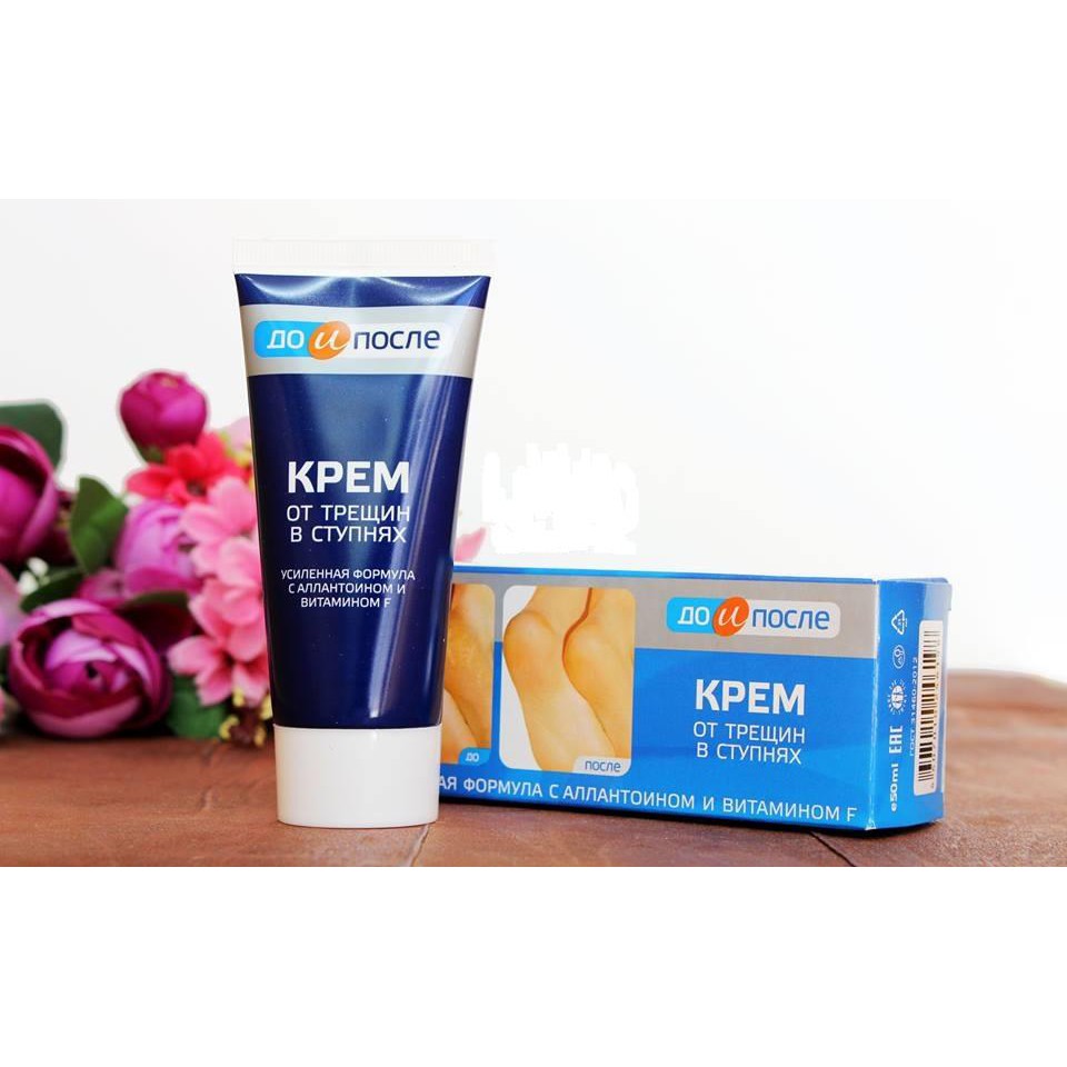 Kem Trị Nứt Gót Chân Nga Kpem 50ml