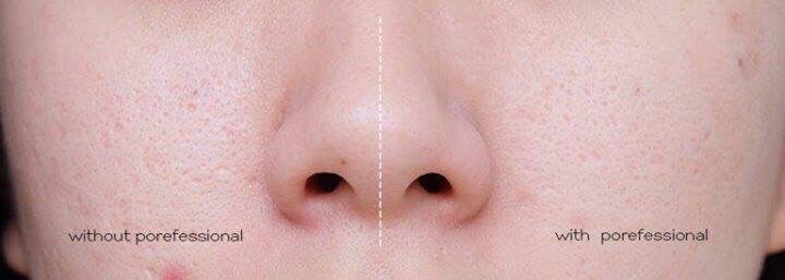 [CÓ SẴN] 🐳 Set Kem Lót Benefit The Pore Fessional POREFECT DEAL 🐳 | BigBuy360 - bigbuy360.vn