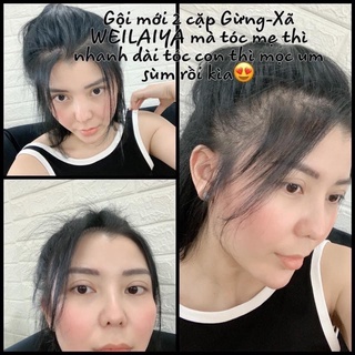HUYẾT THANH SERUM MỌC TÓC WEILAIYA