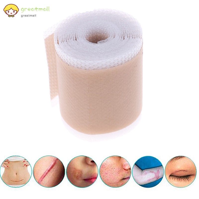 Miếng dán silicon làm mờ sẹo/ mụn hiệu quả | BigBuy360 - bigbuy360.vn