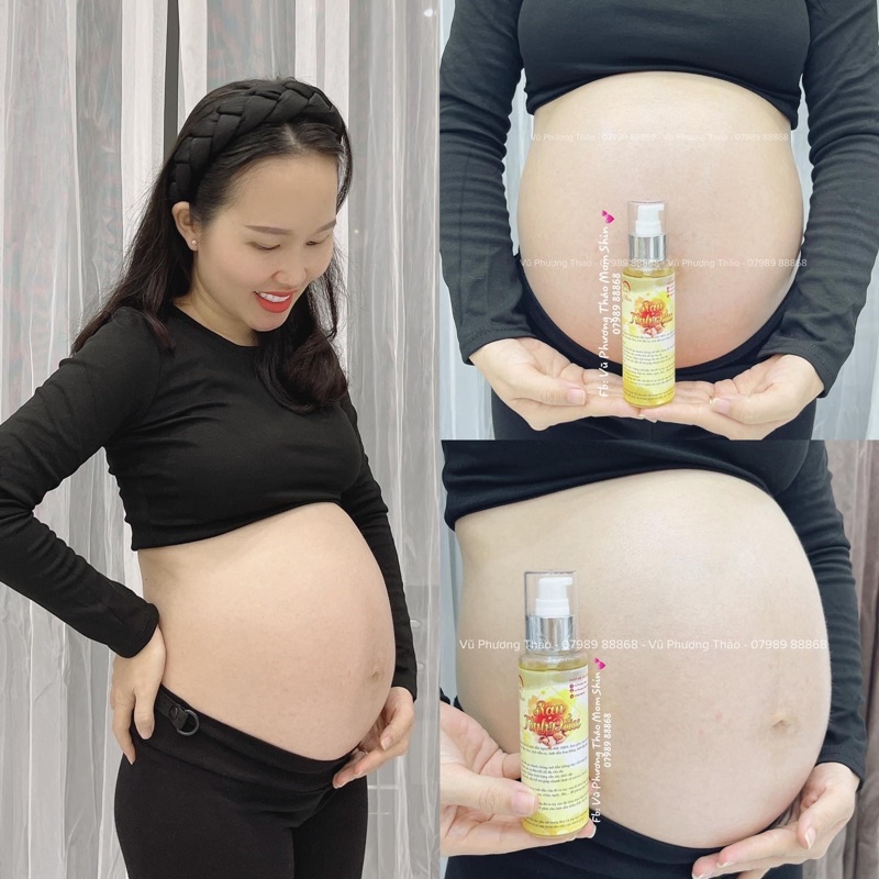 Tinh dầu rạn da Mom Shin 100ml | Phòng ngừa rạn da mẹ bầu | Vũ Phương Thảo Mom Shin | Shop Mẹ Thảo | Ở Cữ Mẹ Shin