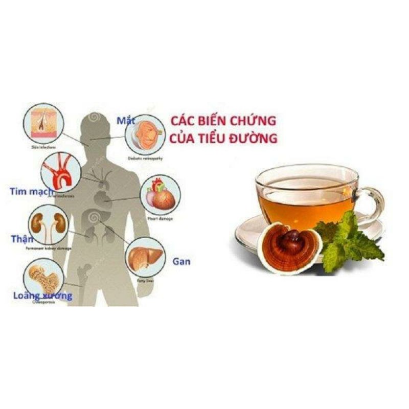 Nấm Linh Chi Hàn Quốc (Linh Chi Nông Lâm nhập khẩu chính ngạch) - hỗ trợ điều trị ung thư, giảm mỡ máu - đau khớp