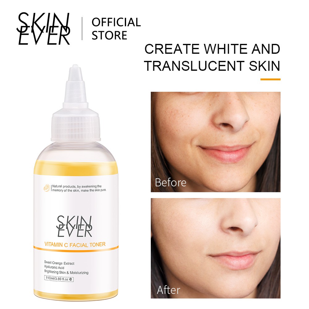 Toner SKIN EVER Vitamin C Dưỡng Trắng Da Mặt Hiệu Quả 110ml | BigBuy360 - bigbuy360.vn