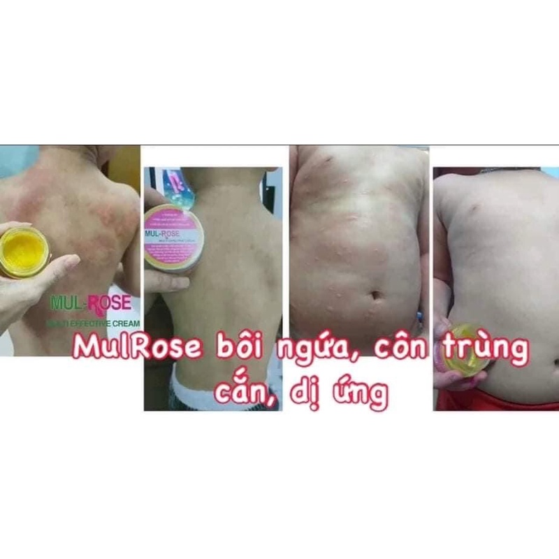 KEM BÔI DA ĐA NĂNG MULROSE 30g Chính hãng
