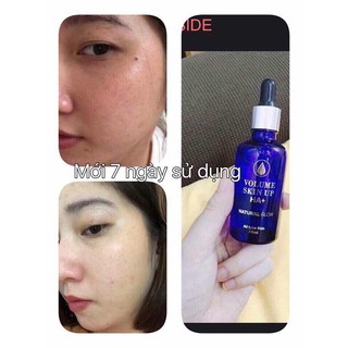 Serum Ha Hàn Quốc- Chai Mini 10ml