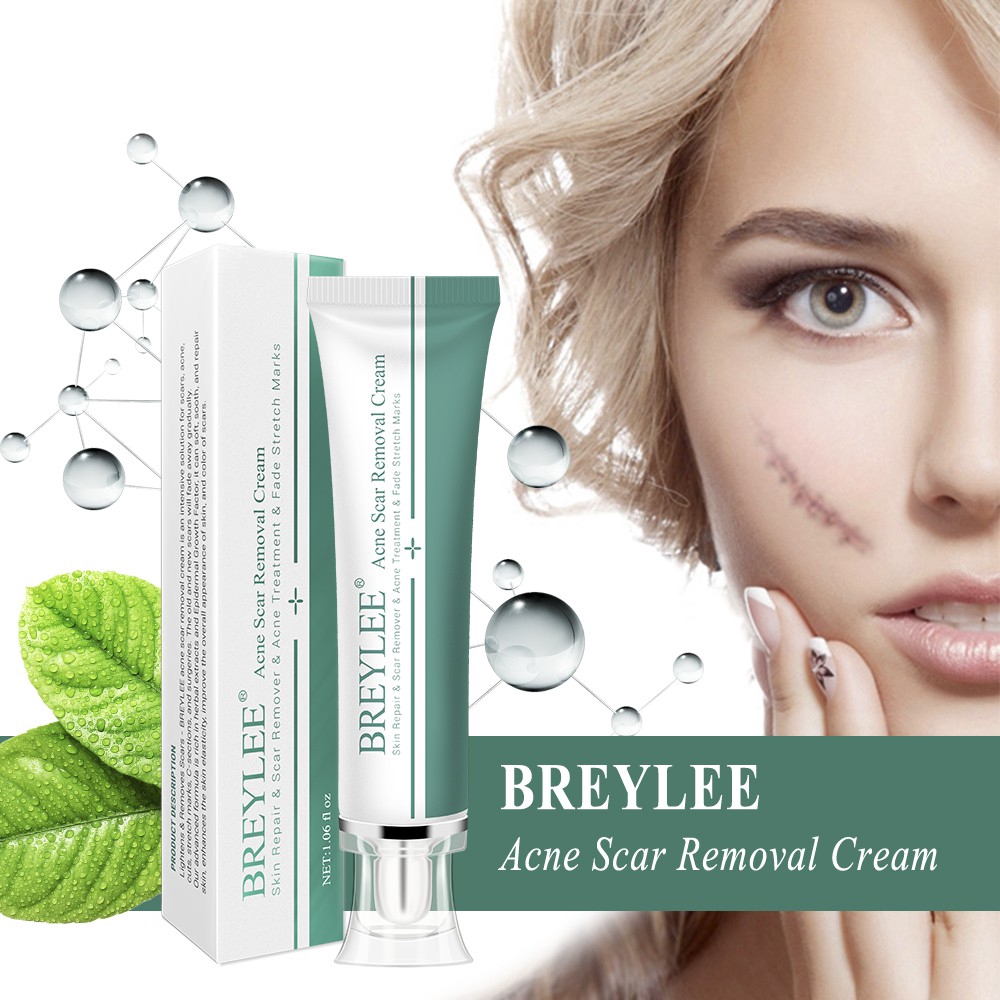 Kem Hỗ Trợ Giảm Sẹo Pimples BREYLEE Làm Sáng Da 30g | BigBuy360 - bigbuy360.vn