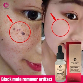 [Hàng mới về] Serum loại bỏ nốt ruồi xóa mờ tàn nhang không đau 20ml