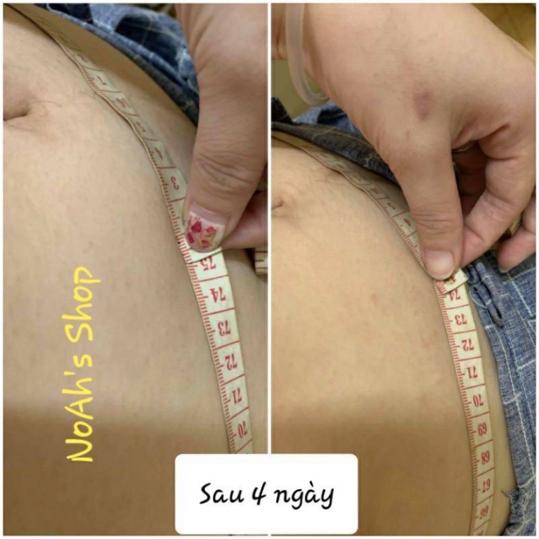 Gel tan mỡ chảy xệ - Kem dưỡng thể Experalta Platinum The Body Lab