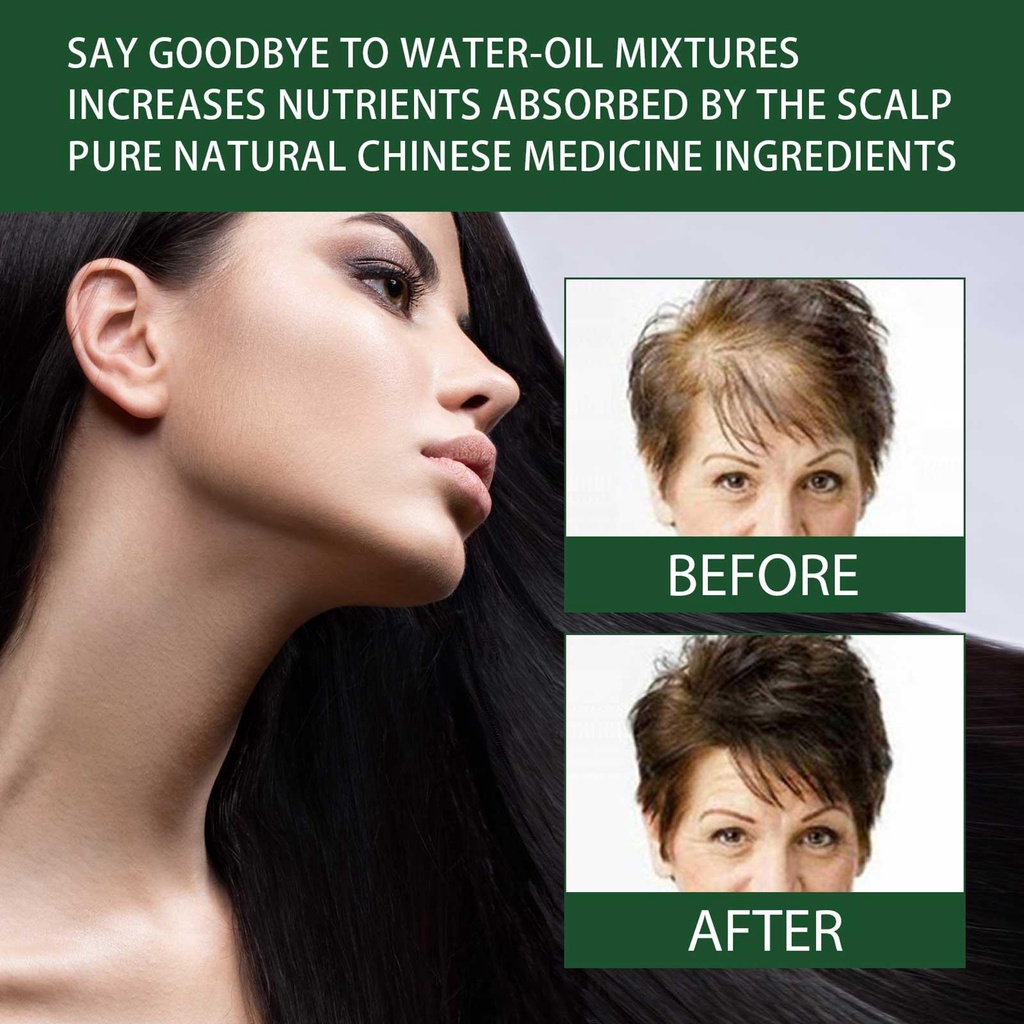 Tinh Chất Gừng Kích Thích Mọc Tóc 30ml C2H7