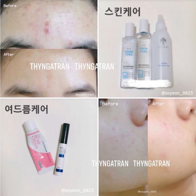 [Bill Hàn] TONER cho da mụn Etude House SOON JUNG pH 5.5 Relief Toner | BigBuy360 - bigbuy360.vn