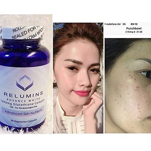 Viên uống trắng sáng da Relumins Advance White 1650mg Glutathione Complex 15x.